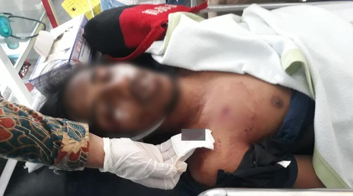 Mahasiswa UHO tewas tertembak