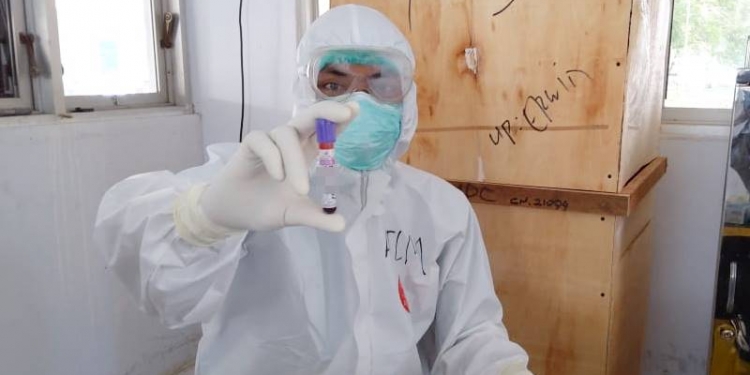 Rapid Test Positif