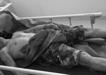 Korban pembacokan sesama penambang