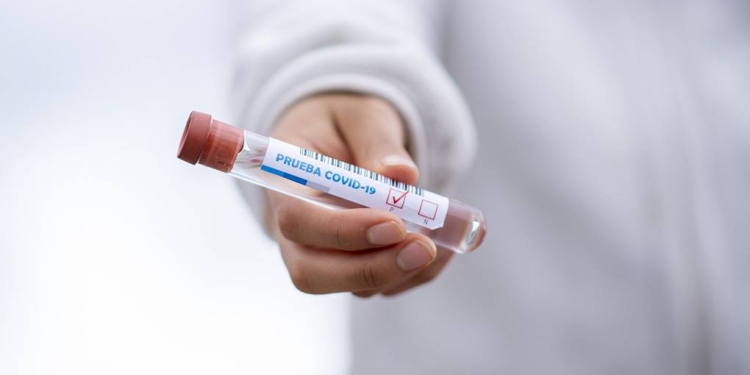 virus corona