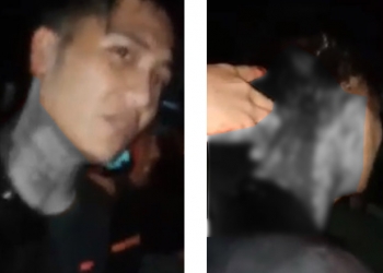 Korban pembacokan di kepala