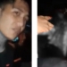 Korban pembacokan di kepala