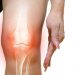 Osteoarthritis