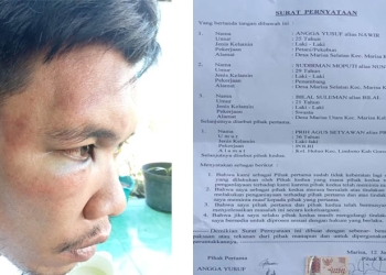 Salah satu korban dugaan penganiayaan oleh oknum Polisi, dan surat pernyaaan damai kedua belah pihak. (istimewa)