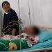 Korban penganiayaan di SMA Negeri 1 Telaga Biru, RS (18) mengalami luka dalam serius sehingga harus dilarikan ke rumah sakit. (Foto: Putra/Gopos)