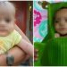 Kondisi bayi yang menjadi pasien pendampingan Yayasan Gorontalo Baik setelah menjalani pengobatan dan dinyatakan sembuh (kiri) dari sebelumnya mengalami infeksi serta gizi buruk sampai harus dilapis daun untuk menjaga kondisi bayi dari infeksi kulit (kanan) (istimewa),