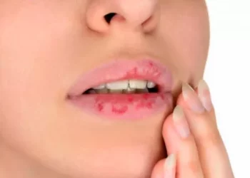 Ilustrasi bibir kering (Pexels/tetiana mandziuk)
