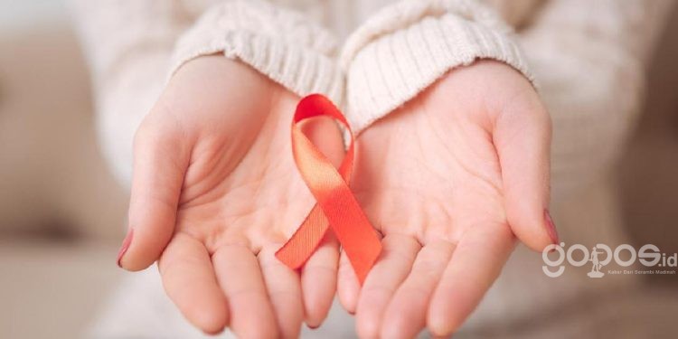 Ilustrasi HIV/AIDS. (istimewa)