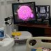 Rumah Sakit Otanaha Kota Gorontalo kini miliki layanan skrining menggunakan Sistem Ultrasonografi Payudara Otomatis Invenia Automated Breast Ultrasound System (ABUS).