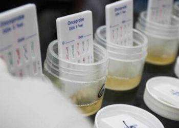 Ilustrasi tes urine (https://www.medicalogy.com/)