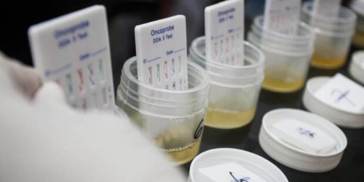 Ilustrasi tes urine (https://www.medicalogy.com/)