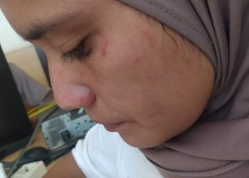 Vidya Mbuinga guru SDN 13 Paguat yang menjadi korban penyerangan oknum orang tua siswa berinisial SM (31).