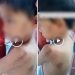 Kondisi sang bocah yang mengalami luka lebam di beberapa bagian tubuh akibat diduga dianiaya ibu tirinya.