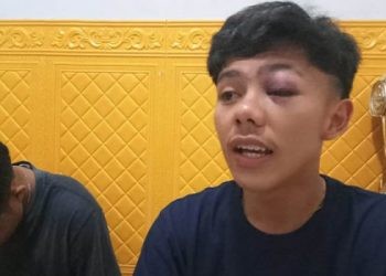 AAP (kanan) memberikan keterangan terkait kasus salah tangkap yang dialaminya.