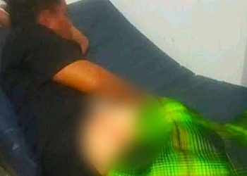 Susan Mokoagow (26) saat dilarikan ke Puskesmas Nuangan.(F. Istimewa)