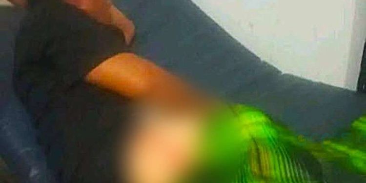 Susan Mokoagow (26) saat dilarikan ke Puskesmas Nuangan.(F. Istimewa)