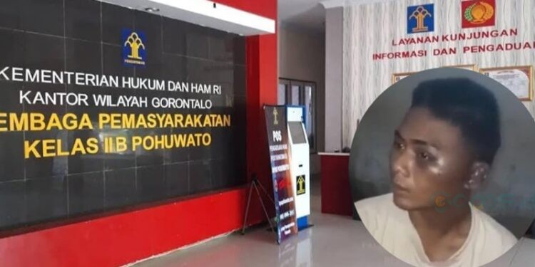 Lapas Kelas II B Pohuwato. Insert salah seorang narapidana korban kekerasan.(istimewa)